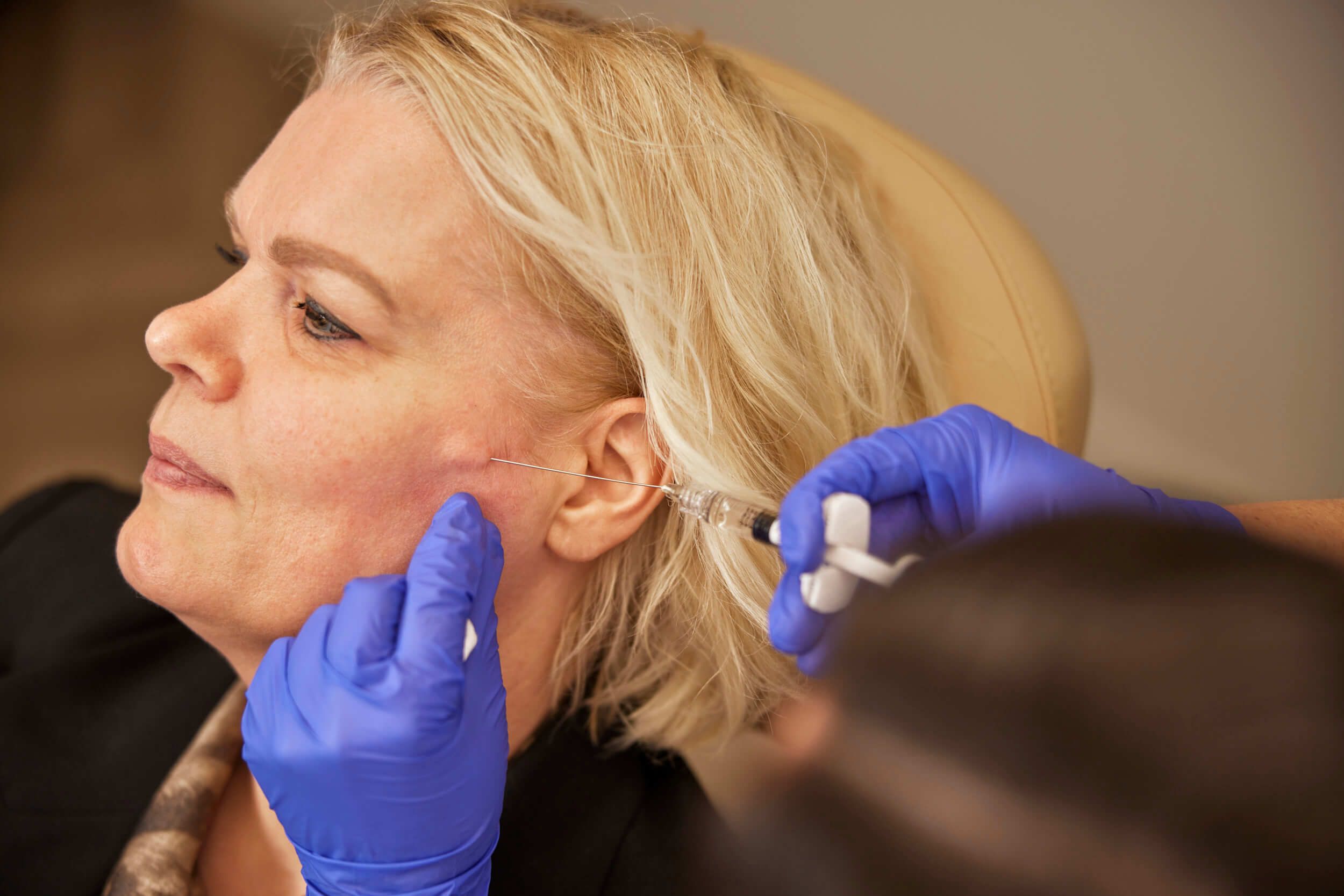 Cosmetisch arts injecteert Profhilo Structura in wangen van client bij The Body Clinic