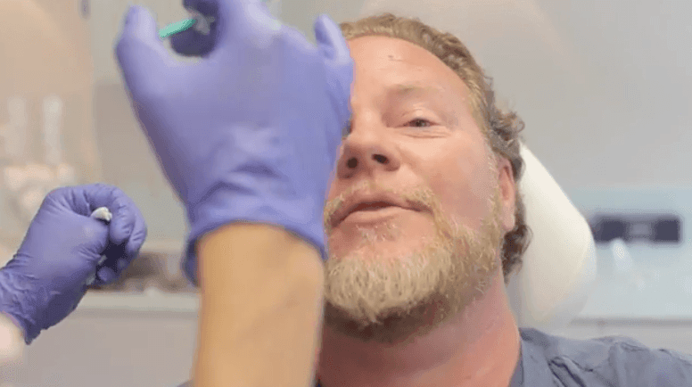 Cosmetisch arts Bart Biermans legt uit hoe je onnatuurlijk botox voorkomt bij The Body Clinic