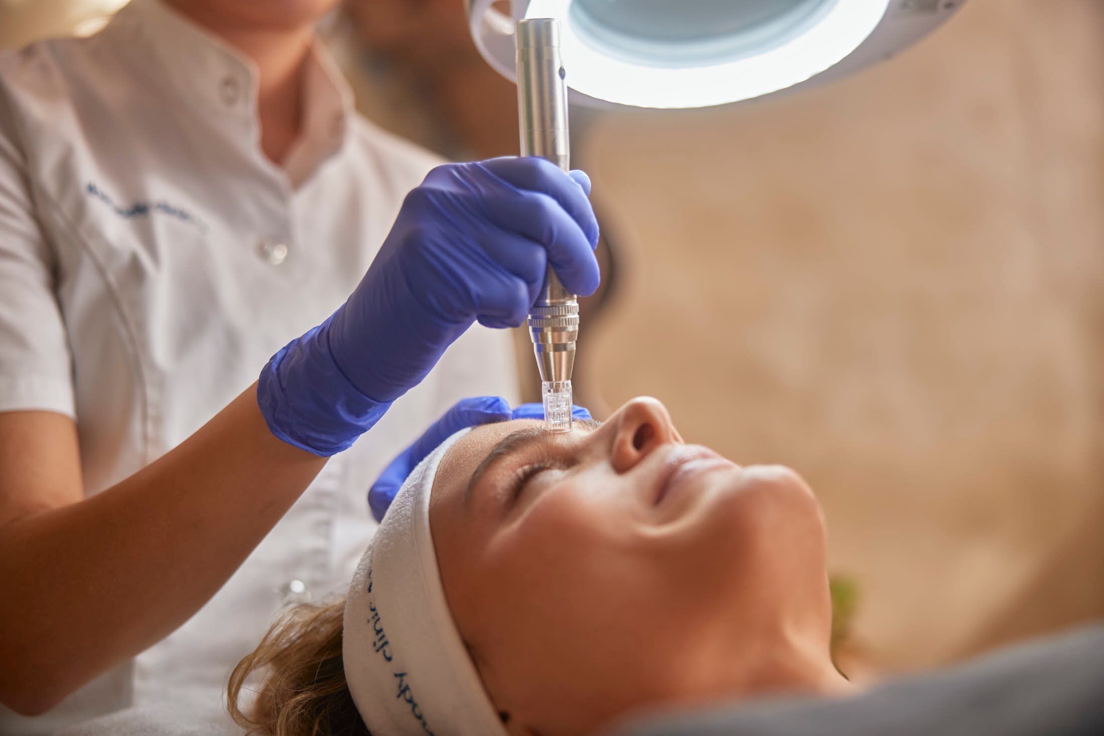 Client ondergaat microneedling behandeling op het gezicht bij The Body Clinic