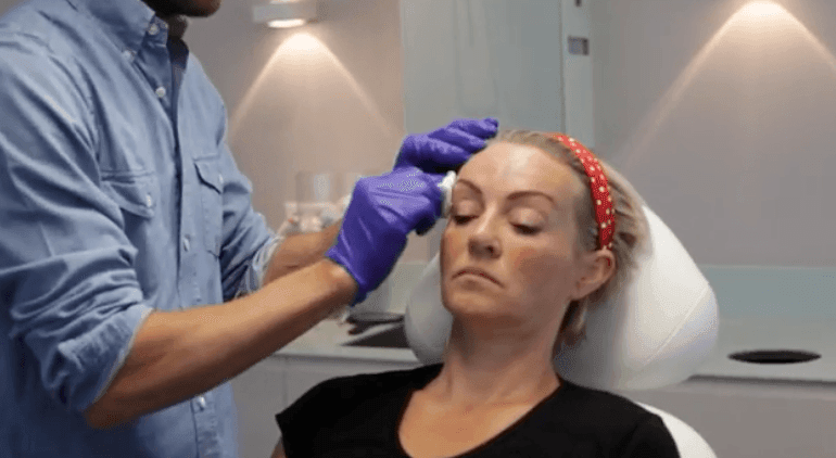 Cosmetisch arts Bart Biermans toont subtiel en natuurlijk botox resultaat bij The Body Clinic